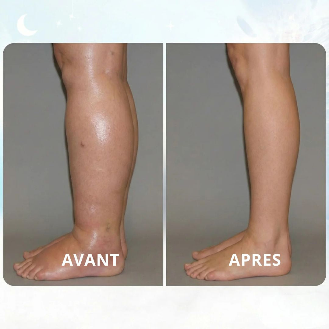 EMS POUR DÉGONFLER LES JAMBES GONFLÉES DEPUIS CHEZ VOUS