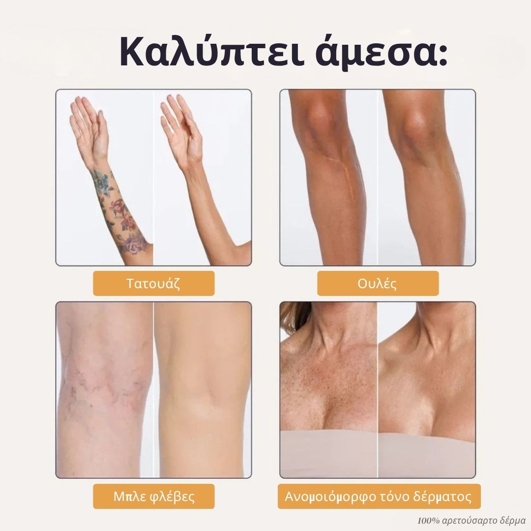 Άμεση Κάλυψη Σώματος