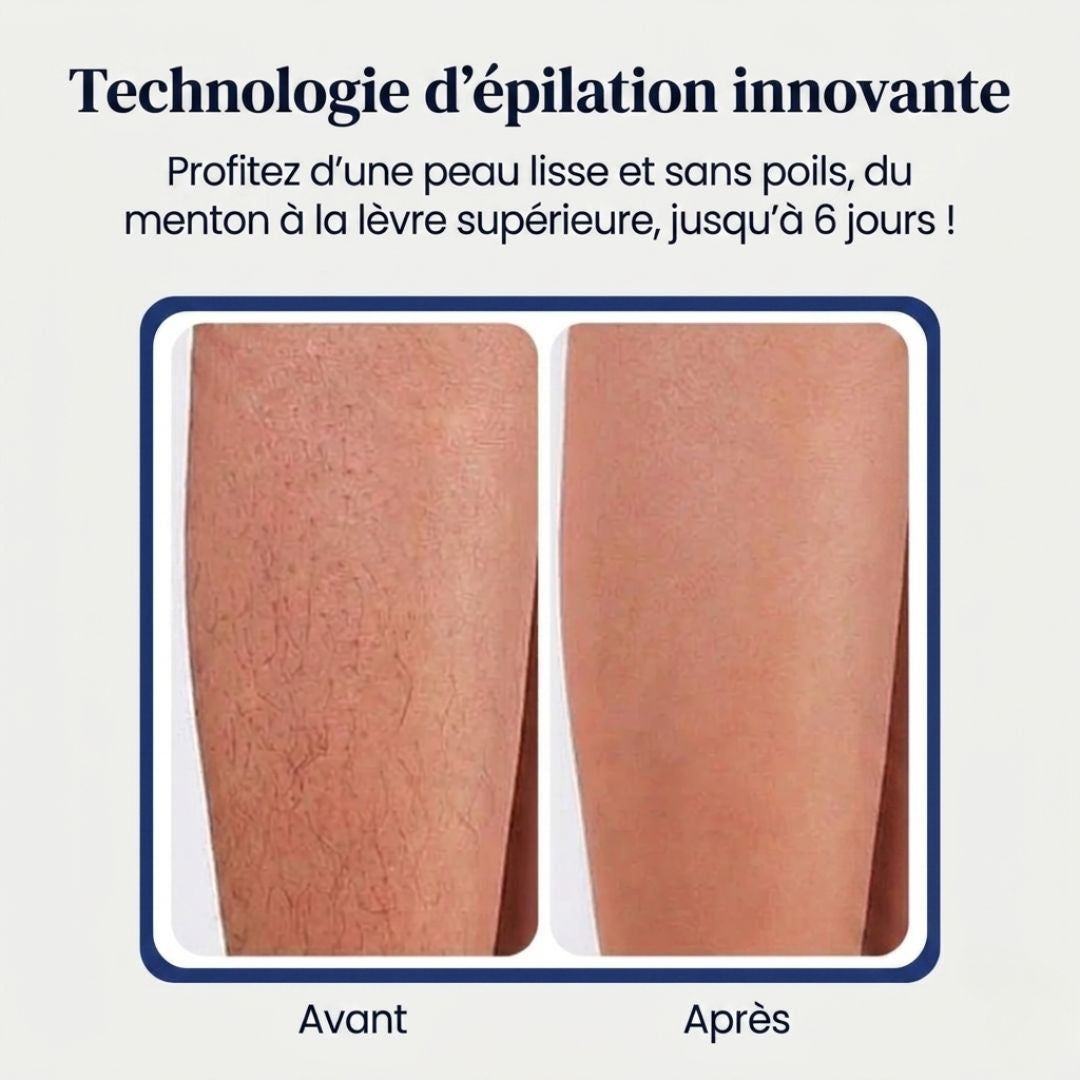 Crème dépilatoire indolore