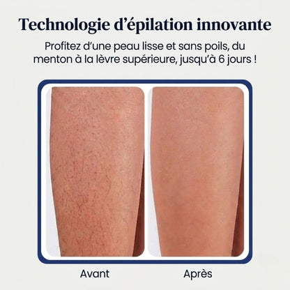 Crème dépilatoire indolore
