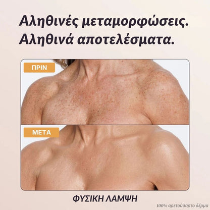 Άμεση Κάλυψη Σώματος