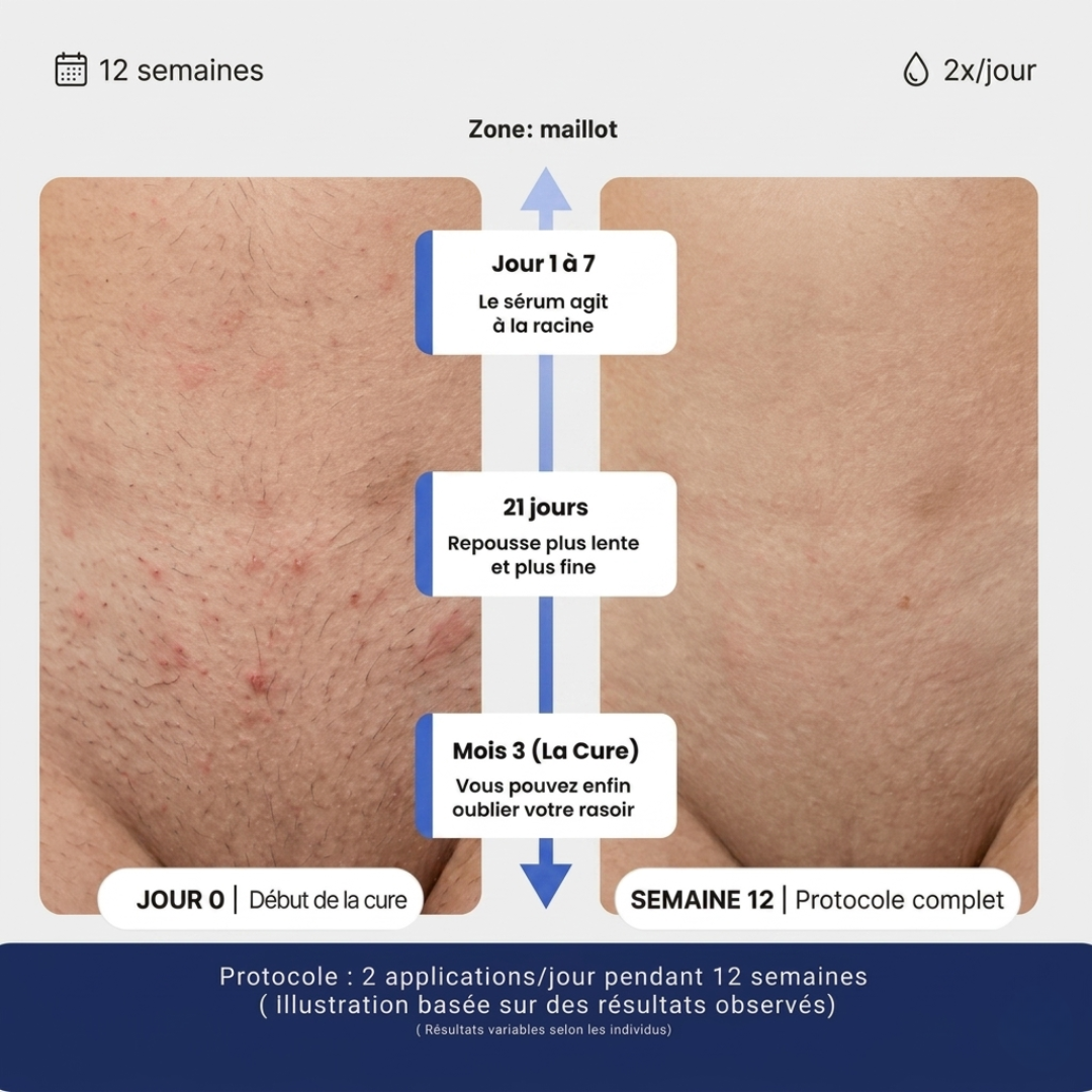 Sérum naturel Anti-Repousse