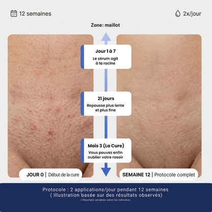 Sérum naturel Anti-Repousse