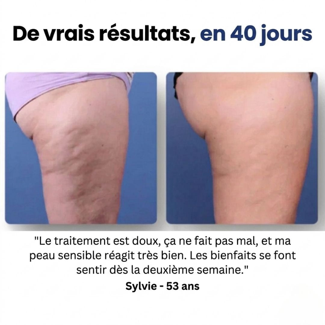 Duviane - Masseur Drainant Anti-Cellulite