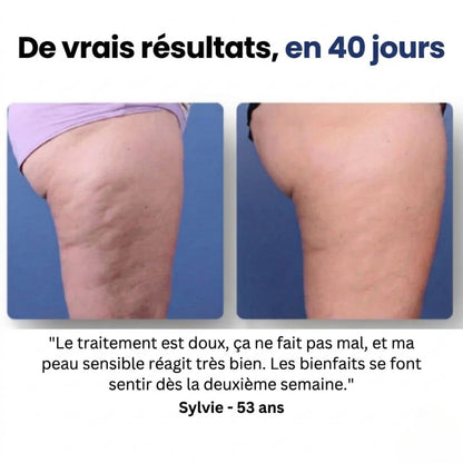 Duviane - Masseur Drainant Anti-Cellulite