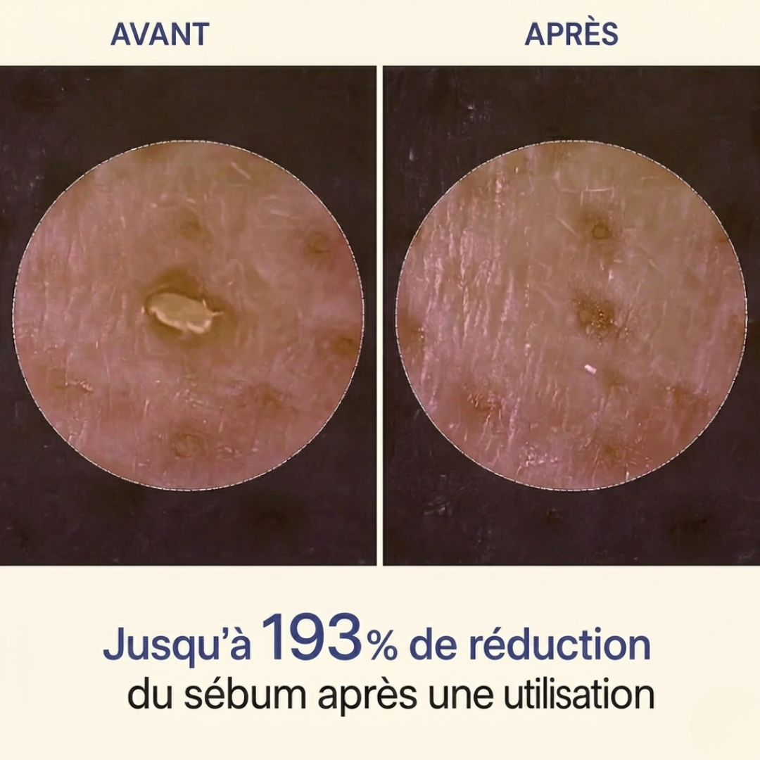 Peel Shot Coréen - Élimine les Impuretés et Sublime Votre Peau