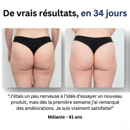 Duviane - Masseur Drainant Anti-Cellulite