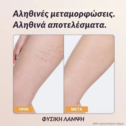 Άμεση Κάλυψη Σώματος