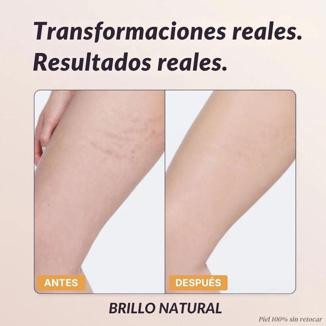 Cobertura Corporal Instantánea - Duviane