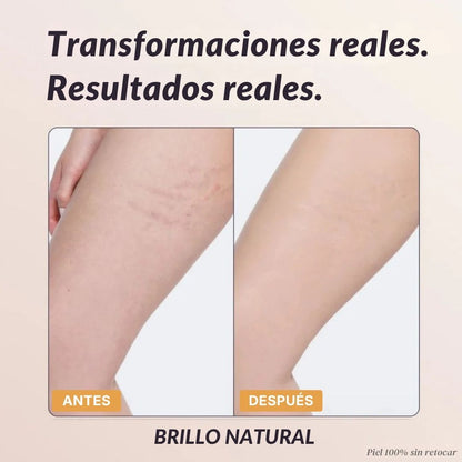 Cobertura Corporal Instantánea - Duviane