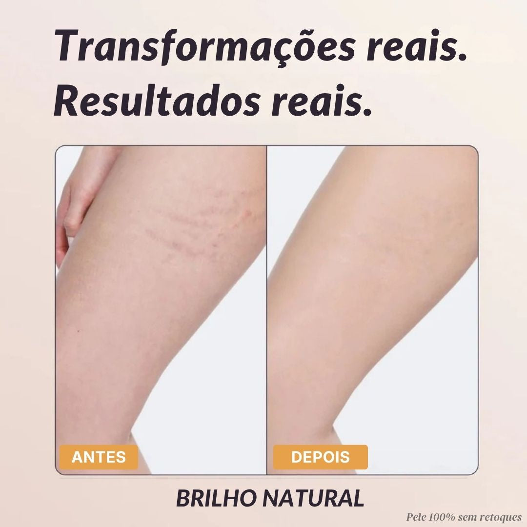 Cobertura Corporal Instantânea - Duviane