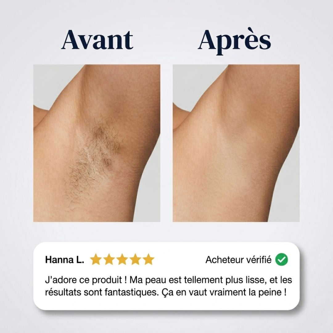 Crème dépilatoire indolore