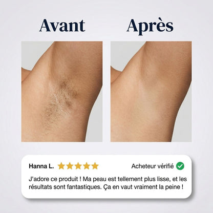 Crème dépilatoire indolore