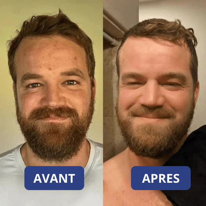 Peel Shot Coréen - Élimine les Impuretés et Sublime Votre Peau